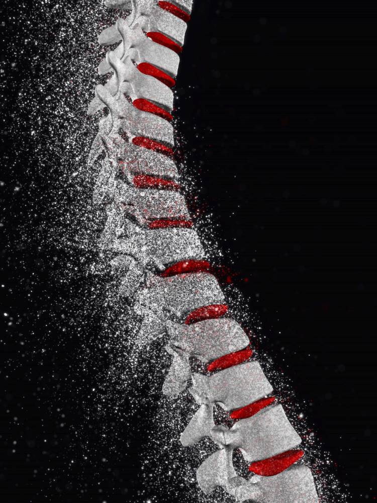 Alterações Osseas na DRC