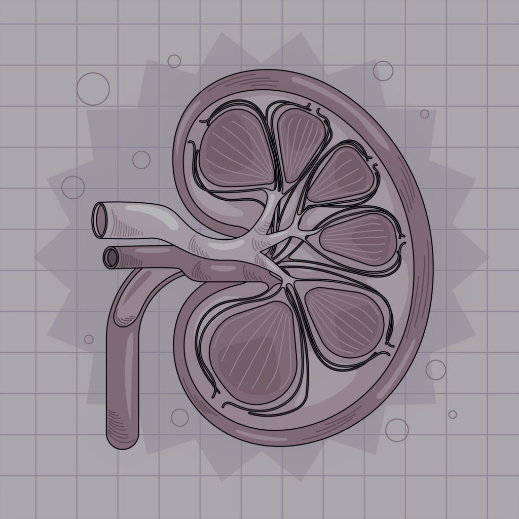 Entenda o que é GESF, seus sintomas, causas, diagnóstico e tratamento. Saiba como essa doença renal pode levar à síndrome nefrótica.